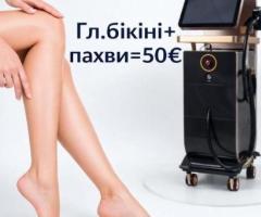 Лазерна епіляція